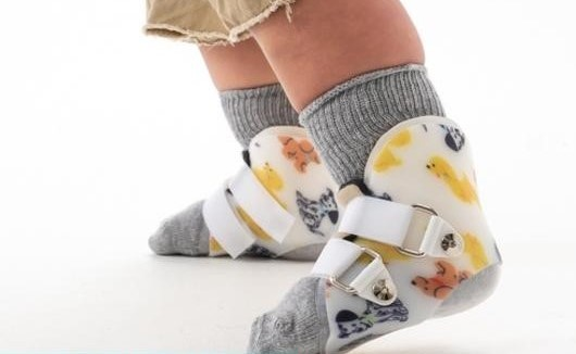 Supra Malleolar Orthoses (SMO)