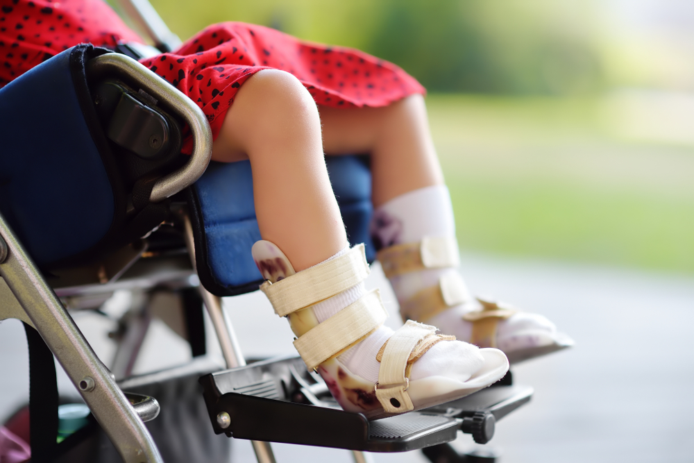 Orthotic Bracing for Active Kids