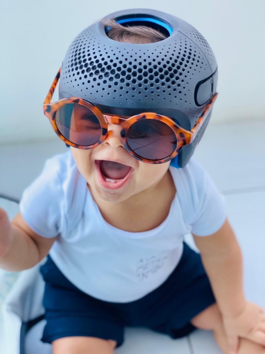 Happy baby wearing Talee cranial helmet with sunglasses
