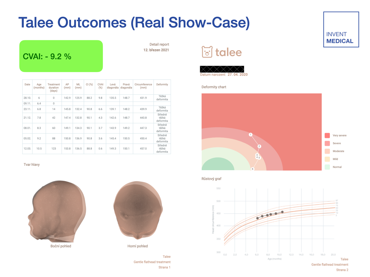 Talee treatment outcomes showing CVAI improvement of -9.2%